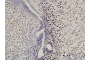 Immunohistochemistry (IHC) image for anti-Homeobox A11 (HOXA11) (AA 60-166) antibody (ABIN561322)