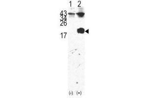 Western blot analysis of FKBP12 antibody and 293 cell lysate either nontransfected (Lane 1) or transiently transfected with the FKBP12 gene (2). (FKBP1A antibody  (AA 43-74))