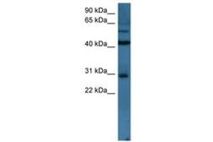 Image no. 1 for anti-T-Cell Leukemia Homeobox 2 (TLX2) (N-Term) antibody (ABIN6746163) (TLX2 antibody  (N-Term))