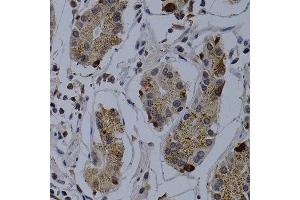 Immunohistochemistry of paraffin-embedded human normal stomach using TNFRSF6B antibody at dilution of 1:200 (400x lens). (TNFRSF6B antibody)