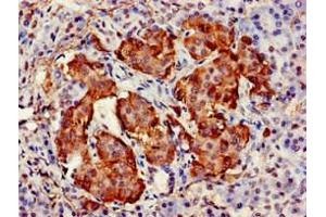Immunohistochemistry of paraffin-embedded human pancreatic tissue using ABIN7171509 at dilution of 1:100 (TARDBP antibody  (AA 1-396))