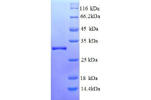 SDS-PAGE (SDS) image for Glutamyl Aminopeptidase (Aminopeptidase A) (ENPEP) (AA 719-949) protein (His tag) (ABIN5712936)