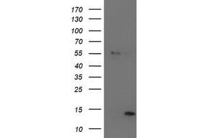 Western Blotting (WB) image for anti-Leukocyte Cell-Derived Chemotaxin 2 (LECT2) (AA 19-151) antibody (ABIN1491076) (LECT2 antibody  (AA 19-151))