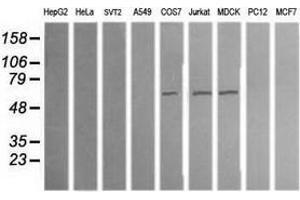 Western Blotting (WB) image for anti-Aldehyde Dehydrogenase 1 Family, Member A3 (ALDH1A3) (AA 1-100), (AA 413-512) antibody (ABIN2715885) (ALDH1A3 antibody  (AA 1-100, AA 413-512))