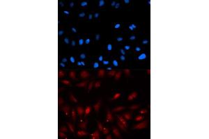 Immunofluorescence (IF) image for anti-Proliferation-Associated 2G4, 38kDa (PA2G4) (AA 1-394) antibody (ABIN6145146)