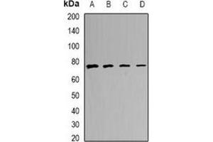 Western blot analysis of CALCOCO1 expression in MCF7 (A), A549 (B), mouse lung (C), mouse heart (D) whole cell lysates.