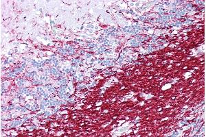 Immunohistochemistry with Brain, cerebellum tissue at an antibody concentration of 5µg/ml using anti-PLP1 antibody (ARP33843_P050) (PLP1 antibody  (N-Term))