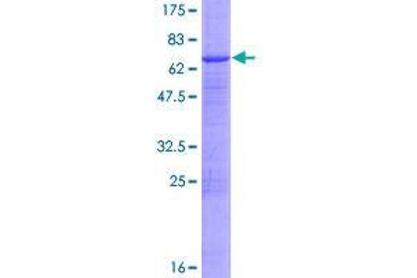 TDP2 Protein (AA 1-362) (GST tag)