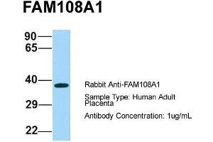 Host: Rabbit  Target Name: FAM108A1  Sample Tissue: Human Adult Placenta  Antibody Dilution: 1.