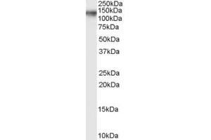 Western Blotting (WB) image for anti-Collagen, Type XXI, alpha 1 (COL21A1) (C-Term) antibody (ABIN2774342)