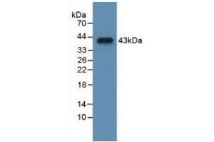 Detection of Recombinant CCK, Mouse using Polyclonal Antibody to Cholecystokinin (CCK) (Cholecystokinin antibody  (AA 1-115))