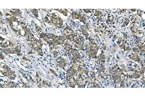 IHC analysis of ASS1 using anti-ASS1 antibody (ABIN7601192).