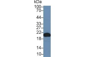 Western Blot; Sample: Human Liver lysate; Primary Ab: 1µg/ml Rabbit Anti-Human CYPB Antibody Second Ab: 0. (PPIB antibody  (AA 47-216))