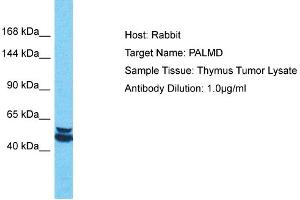 Host: Rabbit Target Name: PALMD Sample Tissue: Human Thymus Tumor Antibody Dilution: 1ug/ml (PALMD antibody  (Middle Region))