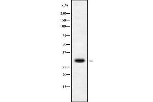 Western blot analysis of MRPS15 using Jurkat whole cell lysates (MRPS15 antibody  (Internal Region))