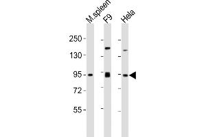All lanes : Anti-SUZ12 Antibody (Center) at 1:2000 dilution Lane 1: mouse spleen lysates Lane 2: F9 whole cell lysates Lane 3: Hela whole cell lysates Lysates/proteins at 20 μg per lane. (SUZ12 antibody  (AA 375-408))