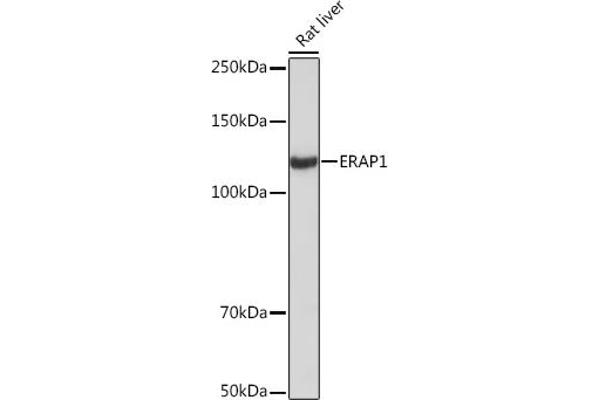 ERAP1 antibody