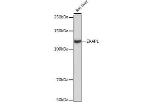 Western blot analysis of extracts of Rat liver, using ER Rabbit mAb (ABIN7266941) at 1:1000 dilution. (ERAP1 antibody)
