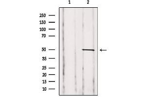 Western blot analysis of extracts from Mouse spleen, using GDI2 Antibody. (GDI2 antibody  (Internal Region))