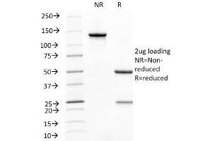 SDS-PAGE Analysis Purified CD31 Mouse Monoclonal Antibody (C31. (CD31 antibody)