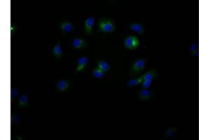 Immunofluorescence staining of MCF7 Cells with ABIN7127404 at 1:50, counter-stained with DAPI. (Recombinant CD47 antibody)