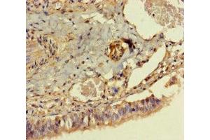 Immunohistochemistry of paraffin-embedded human lung tissue using ABIN7150005 at dilution of 1:100