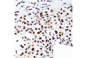 Immunohistochemistry (IHC) image for anti-Tripartite Motif Containing 28 (TRIM28) (AA 576-835) antibody (ABIN1683037)
