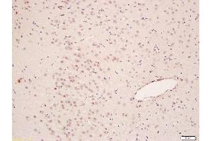 Formalin-fixed and paraffin embedded rat brain labeled with Anti-pan methyl Lysine Polyclonal Antibody, Unconjugated  at 1:200 followed by conjugation to the secondary antibody and DAB staining (Methylated Lysine (methylated) antibody)