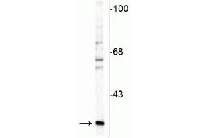 Western blot of rat cerebellar lysate showing specific immunolabeling of the ~29 kDa calretinin protein. (Calretinin antibody)