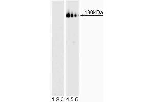 Western blot analysis of PDGFRbeta (pY857). (PDGFRB antibody  (pTyr857))