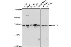 Western blot analysis of extracts of various cell lines, using MTMR9 antibody. (MTMR9 antibody)