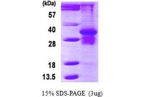 SDS-PAGE (SDS) image for Proteasome (Prosome, Macropain) Subunit, beta Type, 7 (PSMB7) (AA 44-277) protein (His tag) (ABIN6386905)