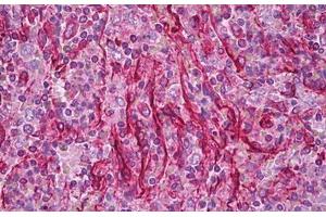 Anti-Vimentin antibody IHC staining of human spleen.