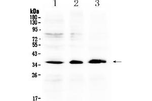 Western blot analysis of AKR1B10 using anti- AKR1B10 antibody .