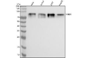 Western blot analysis of MBD1 using anti-MBD1 antibody (ABIN7605500).