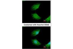 ICC/IF Image Immunofluorescence analysis of methanol-fixed HeLa, using CIAPIN1, antibody at 1:200 dilution. (CIAPIN1 antibody)
