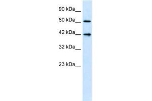 WB Suggested Anti-CFLAR  Antibody Titration: 1. (FLIP antibody  (N-Term))