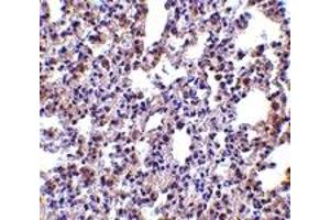 Immunohistochemistry (IHC) image for anti-Eukaryotic Translation Initiation Factor 2-alpha Kinase 2 (EIF2AK2) (C-Term) antibody (ABIN1030589)