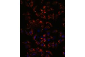 Immunofluorescence analysis of U-2 OS cells using RA antibody (ABIN3015732, ABIN3015733, ABIN3015734, ABIN1682427 and ABIN1682428) at dilution of 1:100. (RAB27A antibody  (AA 1-221))