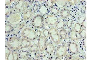 Immunohistochemistry of paraffin-embedded human kidney tissue using ABIN7175278 at dilution of 1:100 (MON1A antibody  (AA 205-555))