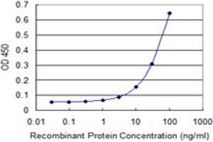 Detection limit for recombinant GST tagged RING1 is 1 ng/ml as a capture antibody. (RING1 antibody  (AA 81-170))
