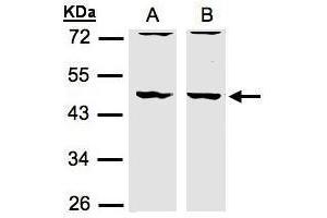 WB Image Sample(30 μg of whole cell lysate) A:HeLa S3, B:MOLT4, 10% SDS PAGE antibody diluted at 1:1500 (DBNL antibody  (N-Term))