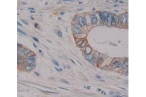 Figure. (Oncostatin M Receptor antibody  (AA 513-760))