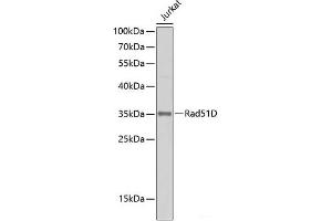 Western blot analysis of extracts of Jurkat cells using Rad51D Polyclonal Antibody at dilution of 1:500. (RAD51D antibody)
