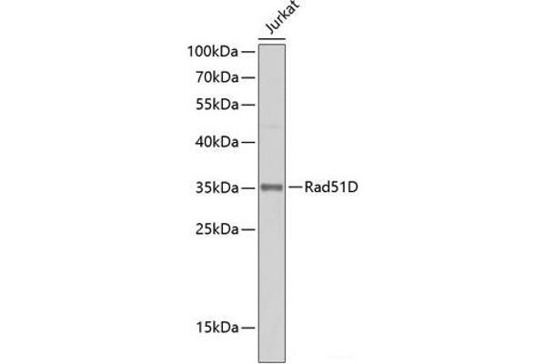 RAD51D Antikörper