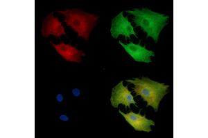 ABIN7095396 and ABIN7099453 staining  cells by IF/ICC.
