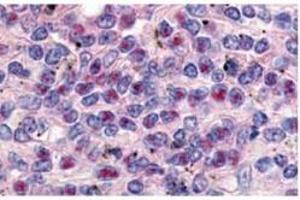 Anti-Cyclin L1a Antibody - Immunohistochemistry  anti-Cyclin L1a antibody was used at a 10 µg/ml to detect Cyclin L1ain a variety of tissues including breast (collagen), heart, kidney (distal tubules), liver, skeletal muscle, ovary (granulosa and oocyte), pancreas (islet), placenta (trophoblast), prostate (epithelium), skin, spleen (endothelium), stomach (chief), testes (seminiferous epithelium and leydig), thymus (Has-sal's corpuscle and lymphocytes) and uterus (glandular epithelium and stroma). (Cyclin L1 antibody  (AA 314-369))
