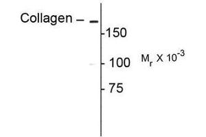 Image no. 1 for anti-Collagen, Type I (COL1) antibody (ABIN372599) (Collagen Type I antibody)
