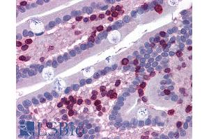 ABIN185717 (3. (ALOX5AP antibody  (Internal Region))