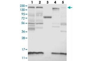 Western blot analysis of Lane 1: RT-4, Lane 2: U-251 MG, Lane 3: Human Plasma, Lane 4: Liver, Lane 5: Tonsil with KIAA1009 polyclonal antibody .